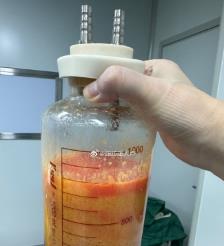 湛江水动力吸脂手术要做多久？